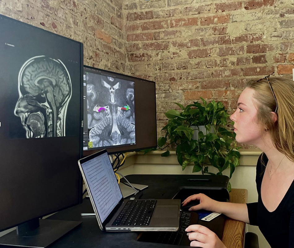 Kate views an image of a human brain on a computer screen.